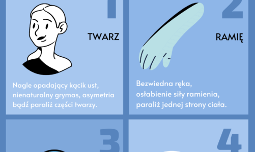 Udar mózgu – co trzeba wiedzieć: Spastyczność poudarowa, czyli jak odzyskać sprawność po udarze